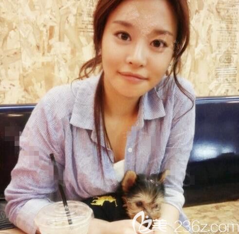 韓國綺林整形外科做了下巴T型截骨真人案例