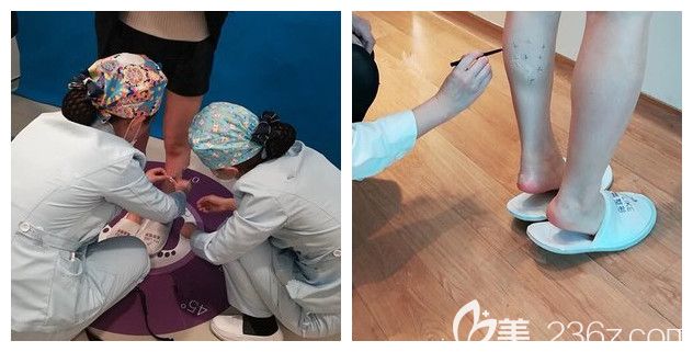 注射前測量腿圍標(biāo)注瘦腿注射位置