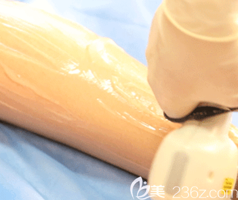 北京藝星醫(yī)生給我進(jìn)行冰點(diǎn)脫毛時(shí)候照片 北京藝星醫(yī)生給我進(jìn)行冰點(diǎn)脫毛時(shí)候照片