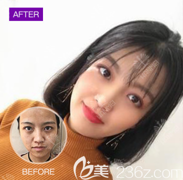 遵義韓美祛斑 遵義韓美祛斑