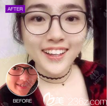 遵義韓美牙齒矯正 遵義韓美牙齒矯正