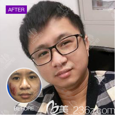 遵義韓美整形可以祛疤嗎 遵義韓美整形可以祛疤嗎