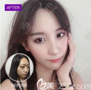 遵義韓美吸脂怎樣 遵義韓美吸脂怎樣