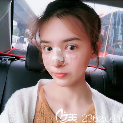 廣州美萊雙眼皮修復(fù)術(shù)后7天拆線 廣州美萊雙眼皮修復(fù)術(shù)后7天拆線