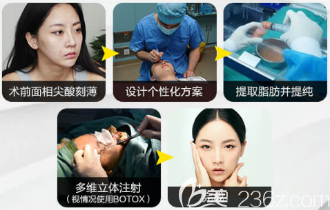 廣州美萊馮志勇醫(yī)生面部脂肪填充過(guò)程圖 廣州美萊馮志勇醫(yī)生面部脂肪填充過(guò)程圖