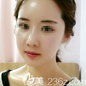 韓國(guó)必嫵做雙鄂手術(shù)怎么樣？分享我在韓國(guó)必嫵做納米雙顎手術(shù)+額頭填充+芭比翹鼻的效果