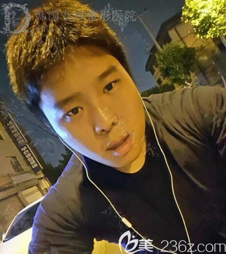 感謝韓國女神醫(yī)院免費給我做了眼綜合面部脂肪溶脂面部提升現(xiàn)在的我氣質(zhì)大不同