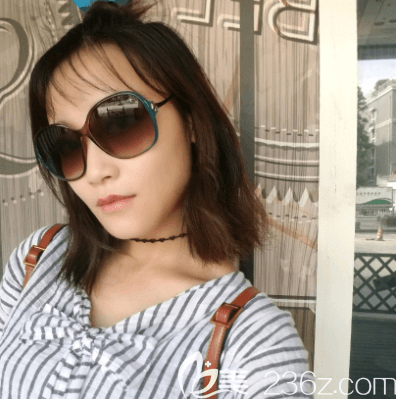 我在北京藝美注射海薇玻尿酸豐唇第7天效果 我在北京藝美注射海薇玻尿酸豐唇第7天效果