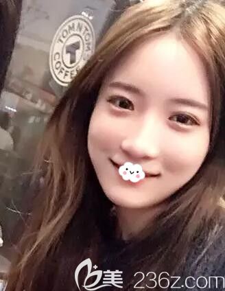 有人說外切眼袋后悔死了，我找韓國(guó)歐米茄整形醫(yī)院做晶透下眼皮整形去眼袋+黑眼圈后擁有臥蠶