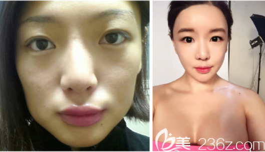 20190612_1560310653756713.png image.png