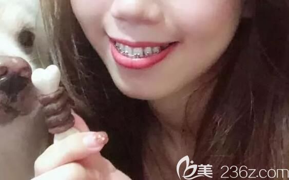 在<!--<i data=20240703-sp></i>-->雅悅口腔做矯正中