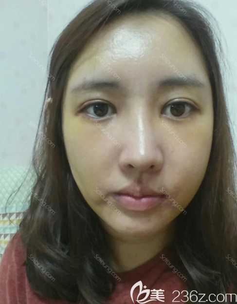 20190612_1560318826424703.png 20190612_1560318826424703.png