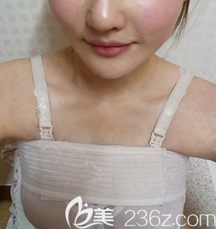南充韓美自體脂肪隆胸術(shù)后即刻