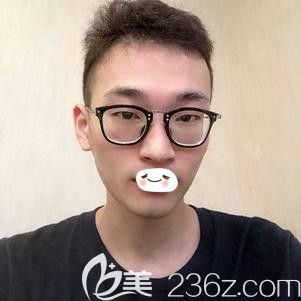 在石家莊天伊美做紅藍光祛痘一周痘痘痘印明顯改善 在石家莊天伊美做紅藍光祛痘一周痘痘痘印明顯改善