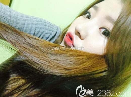 130斤的既視感在韓國瑪博爾整形范做了鼻子和溶脂提升感覺減了20斤