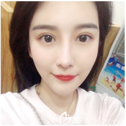 中信惠州醫(yī)院整形美容科做雙眼皮怎么樣