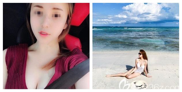 因?yàn)樾匦K遭分手后的她花一萬多到無錫麗都做了進(jìn)口娜綺麗假體隆胸，三個(gè)月性感身材逆襲打臉前任