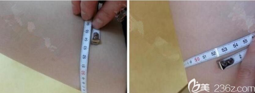 腿圍前后變化 腿圍前后變化