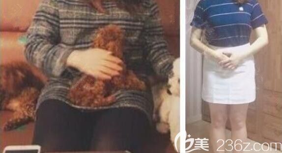 韓國美爾韓整形外科醫(yī)院減肥真人<span style= 韓國美爾韓整形外科醫(yī)院減肥真人<span style=