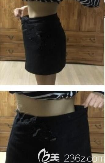 胖了好多年在韓國美爾韓吃減肥韓藥腹部冷凍溶脂瘦身針大腿ADIPO高周波溶脂3個月后我瘦了13公斤