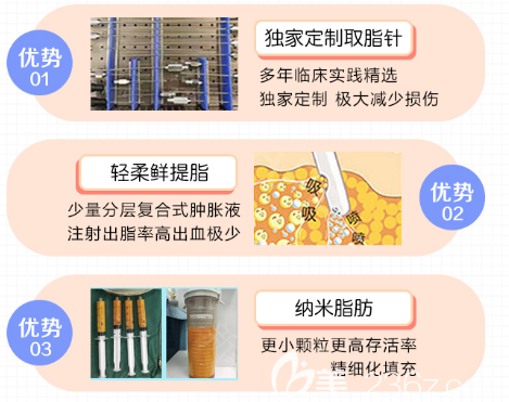 深圳麗港麗格自體脂肪填充的優(yōu)勢(shì)