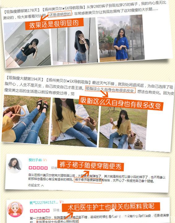 對揚州美貝爾SX導(dǎo)航吸脂評價