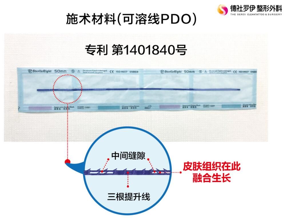 普羅菲耳線雕可溶線PDO核心技術(shù) 普羅菲耳線雕可溶線PDO核心技術(shù)