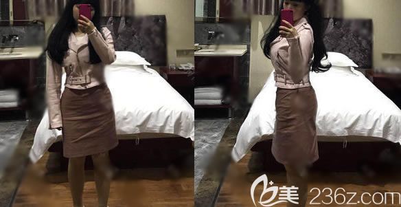 義烏連天美腰腹吸脂<span style= 義烏連天美腰腹吸脂<span style=