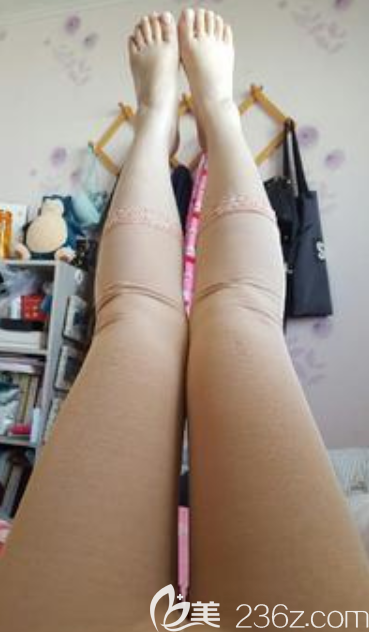 大腿吸脂抽了2900CC韓國(guó)麗穎整形外科安相泰術(shù)前大腿圍60cm1個(gè)月53cm