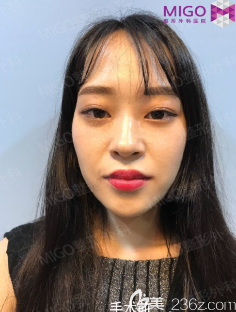 20190617_1560737813998796.png 20190617_1560737813998796.png