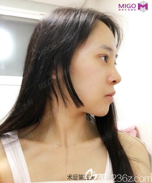 20190617_1560737901386817.png 20190617_1560737901386817.png