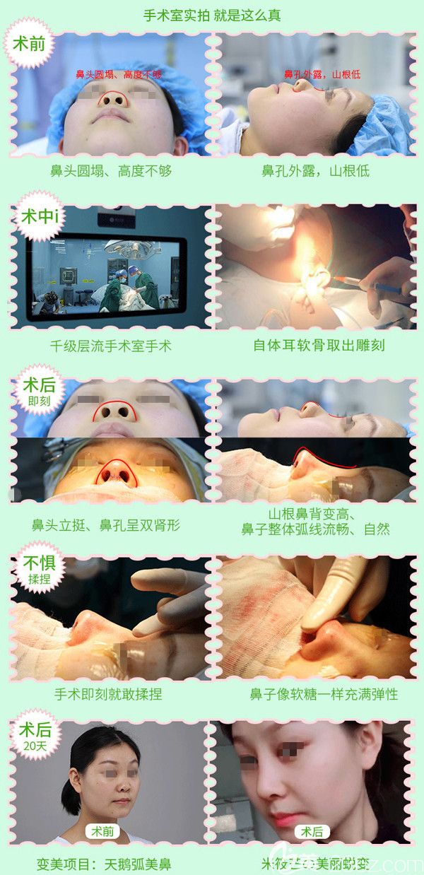 到連云港華美做鼻綜合分享