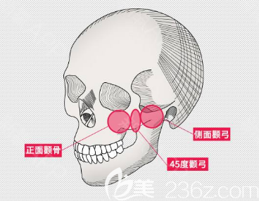 顴骨示意圖