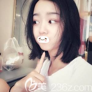 在張家口維多利亞做雙眼皮術(shù)后10天慢慢消腫