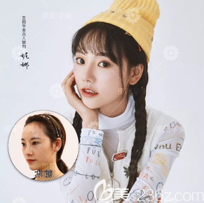 貴州哪個醫(yī)院隆鼻好