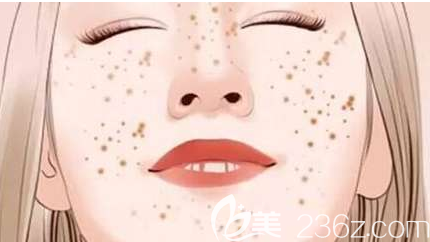 福州瑪恩陳意蕾醫(yī)生科普激光美膚可以保持多久