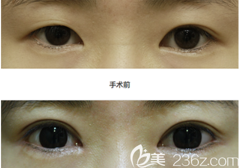 20190618_1560839056738033.png image.png