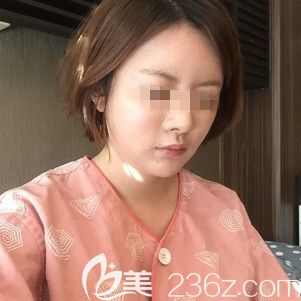 在韓國(guó)ARTLINE做面部吸術(shù)前 在韓國(guó)ARTLINE做面部吸術(shù)前