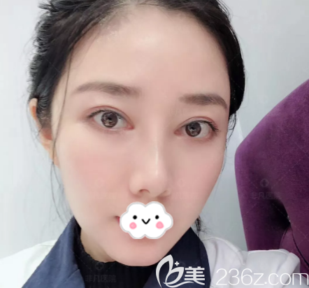 深圳雙眼皮修復哪個醫(yī)生好？公開我去深圳非凡找王天成做雙眼皮修復的親身經(jīng)歷