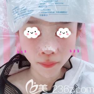 <!--<i data=20240703-sp></i>-->醫(yī)生幫我做鼻部修復(fù)術(shù)后即刻