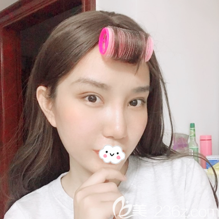 我這次去廣州海峽找閆愛(ài)躍做自體脂肪全臉填充抽的是大腿的脂肪,真的是一舉兩得啊