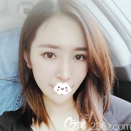 我來告訴你廣州紫馨李石峰做鼻子怎么樣 我來告訴你廣州紫馨李石峰做鼻子怎么樣