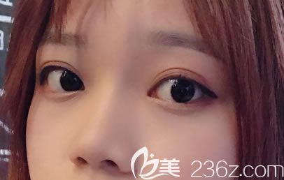 杭州薇琳雙眼皮<span style= 杭州薇琳雙眼皮<span style=