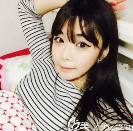 輪廓三件套打卡韓國首爾麗溫REON樸庭逸，沒有下垂反而更童顏了