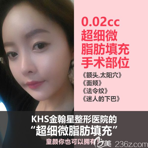 韓國KHS金翰星整形醫(yī)院超細(xì)微脂肪移植 韓國KHS金翰星整形醫(yī)院超細(xì)微脂肪移植