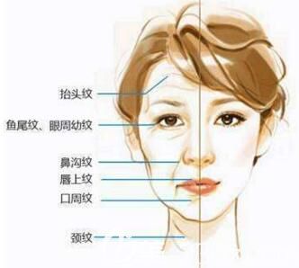 皮膚膠原蛋白流失導(dǎo)致面部出現(xiàn)各種細(xì)紋衰老現(xiàn)象