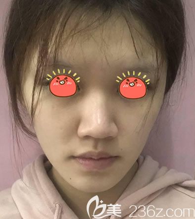 在杭州薇琳做面部<span style= 在杭州薇琳做面部<span style=