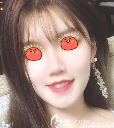 杭州薇琳面部提升術(shù)<span style= 杭州薇琳面部提升術(shù)<span style=