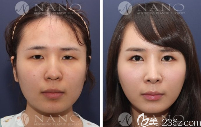 20190624_1561346316943486.png 20190624_1561346316943486.png