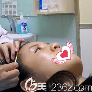 孫蘇寧醫(yī)生為我做面部填充脂肪術(shù)前消毒 孫蘇寧醫(yī)生為我做面部填充脂肪術(shù)前消毒